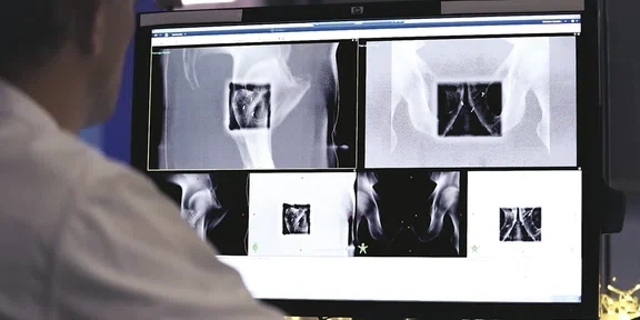 Магнитно-резонансный томограф GE SIGNA  Artist 1,5 Тл