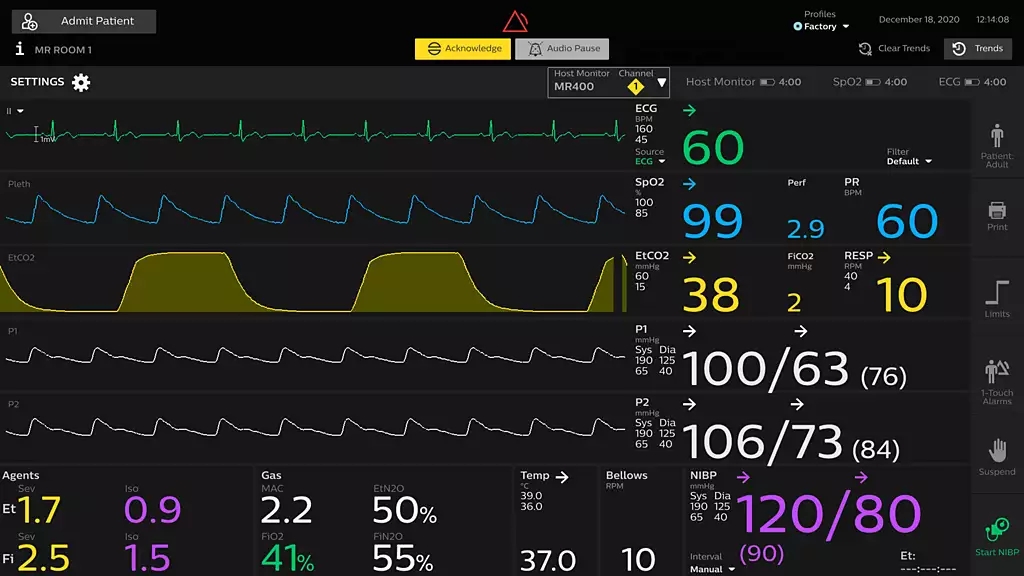 Система Philips MR Patient Care Portal 5000