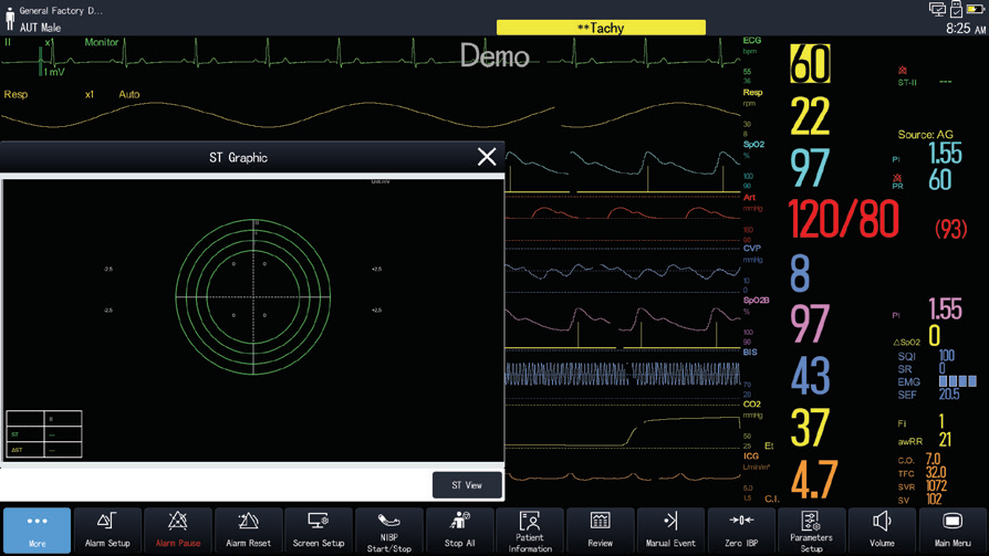 Фото Монитор пациента переносной COMEN K18 Pro