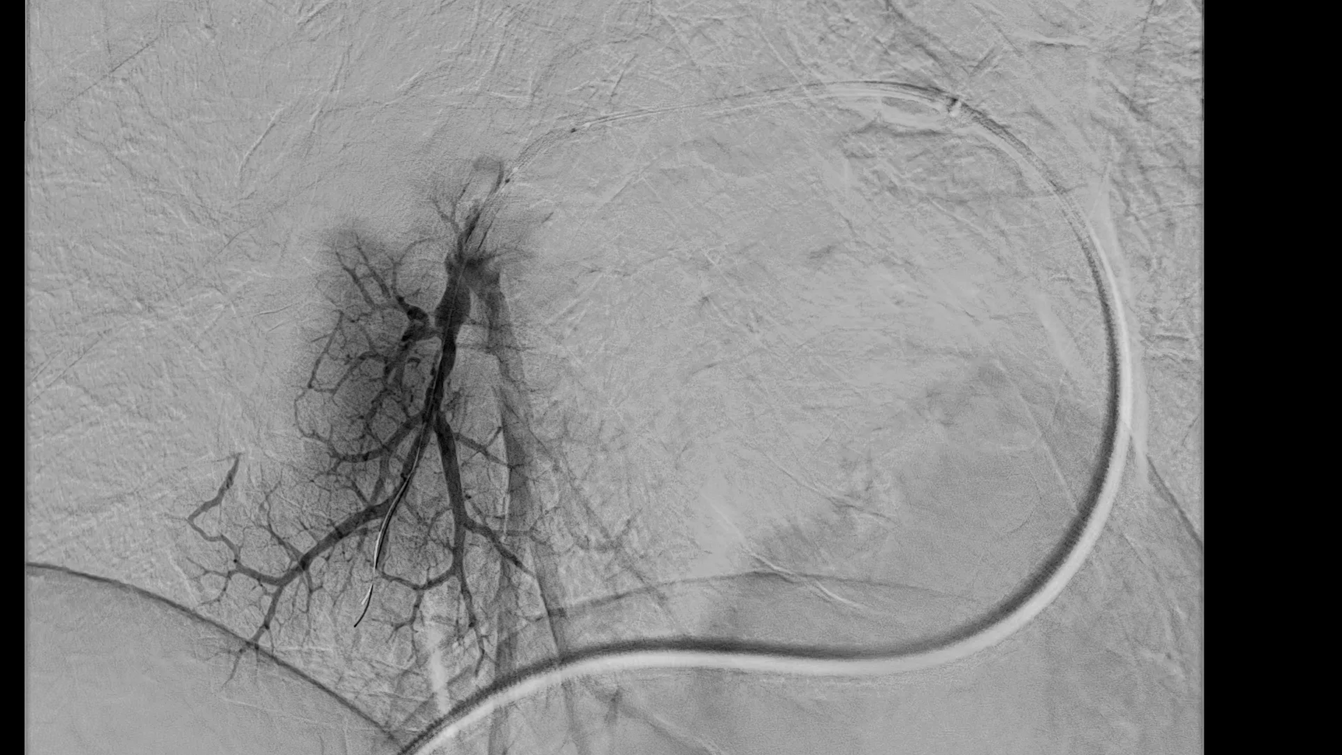 Philips Azurion 7 M20