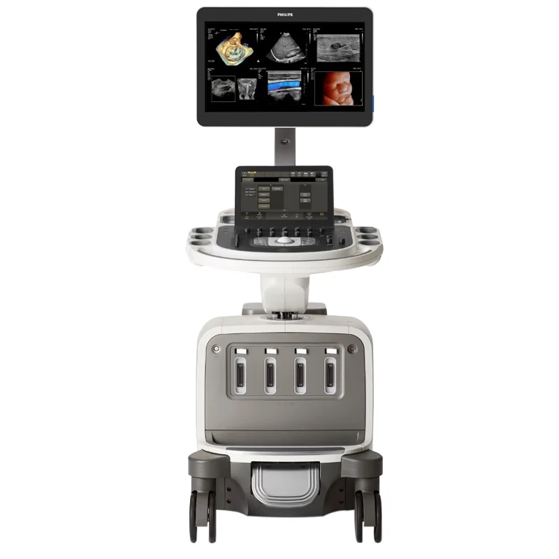 Премиальная ультразвуковая система Philips EPIQ Elite