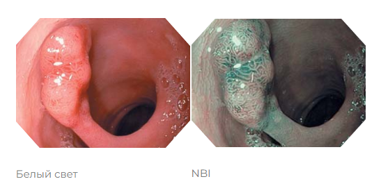 NBI.png NBI.png
