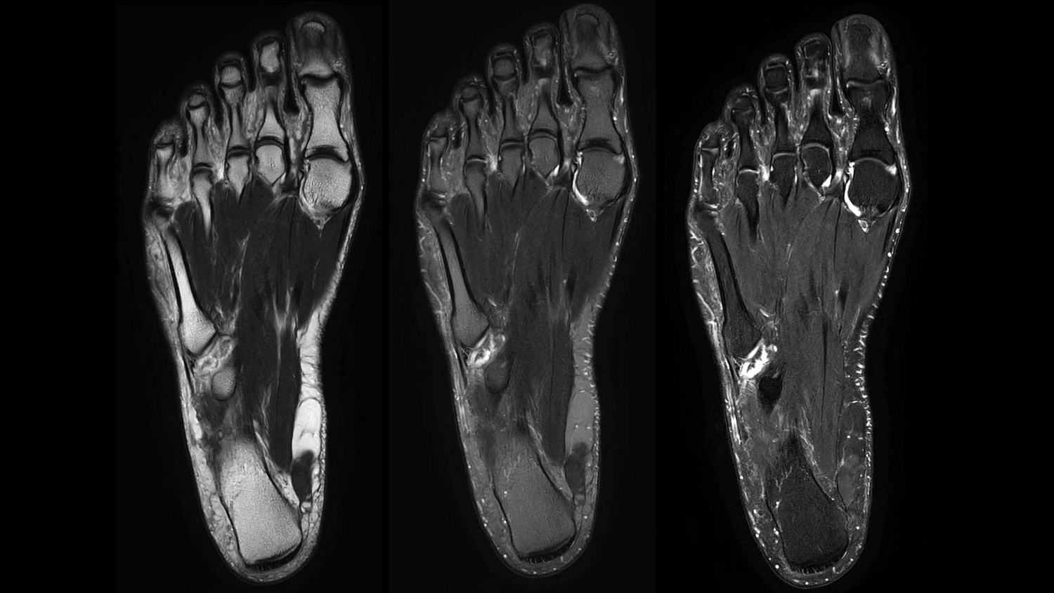 Магнитно-резонансный томограф Philips Ingenia Elition 3.0T S