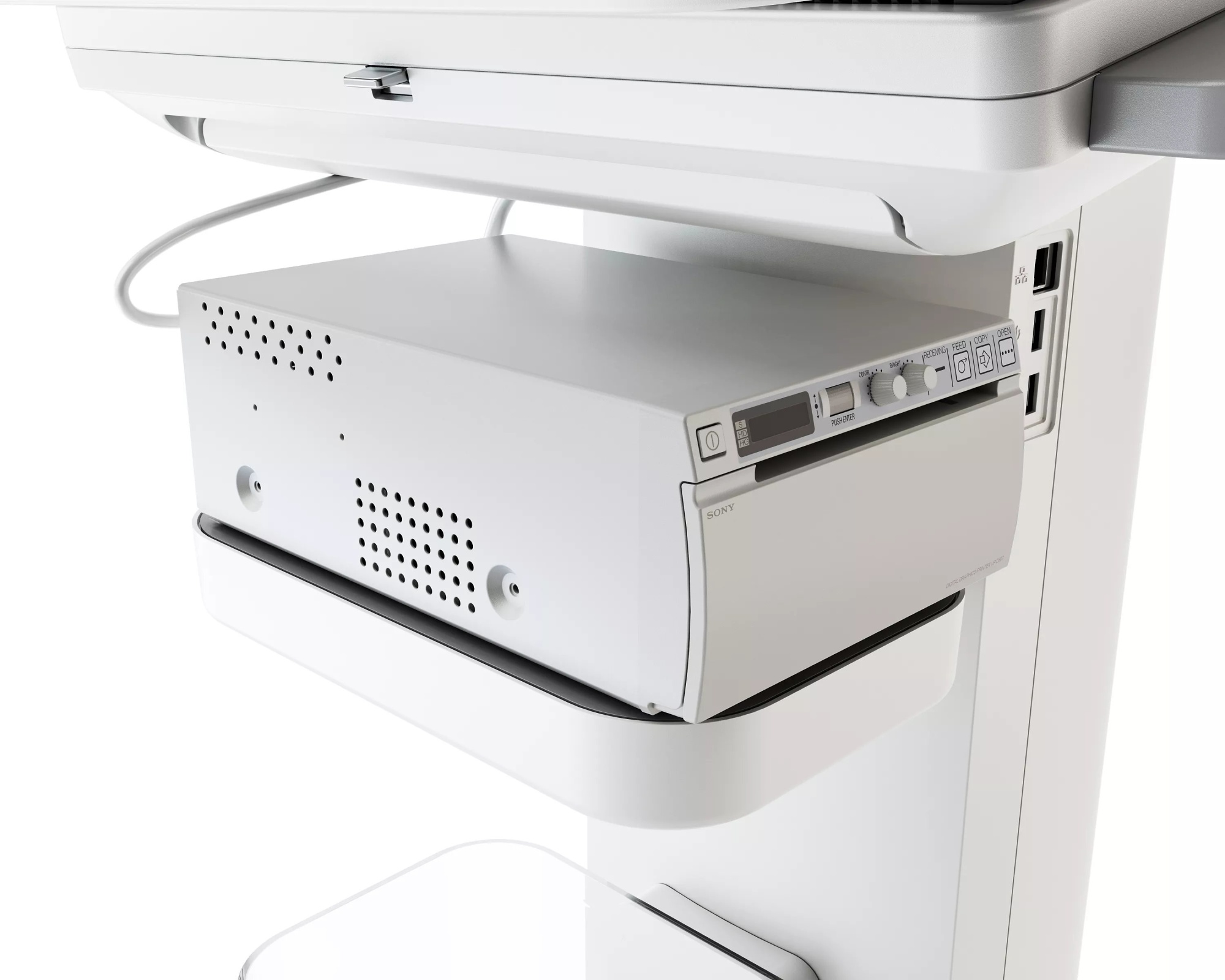 Портативная компактная ультразвуковая система Philips 5500CV