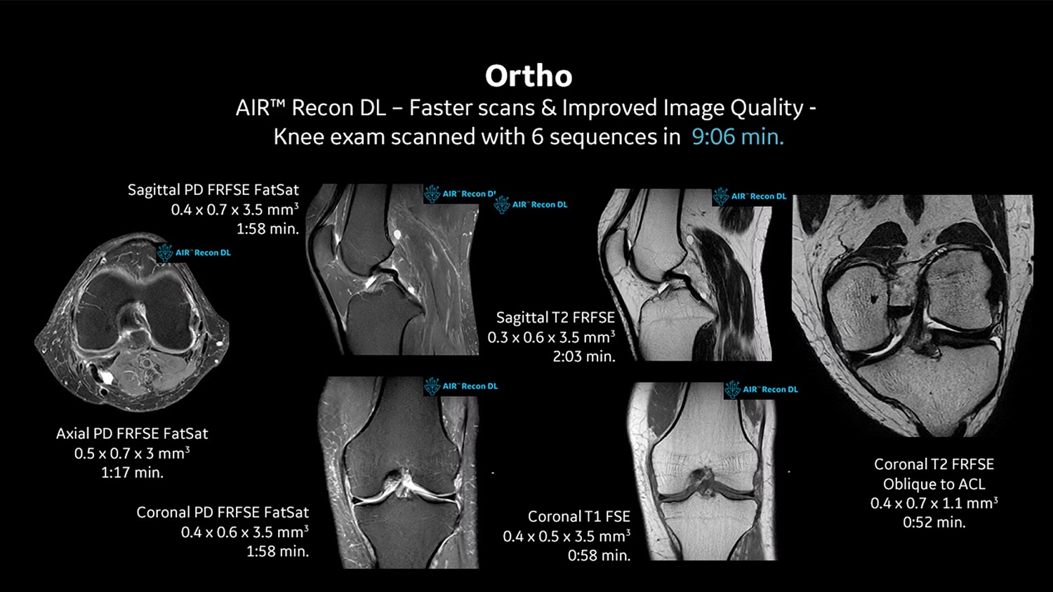 Магнитно-резонансный томограф GE SIGNA Creator 1.5 Тл. 