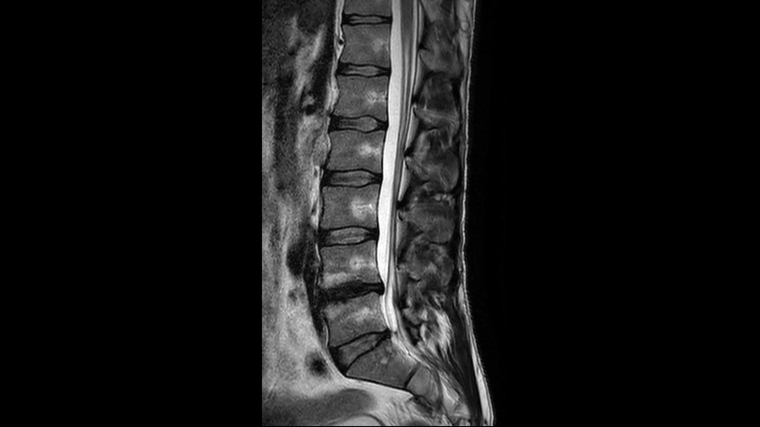 Магнитно-резонансный томограф Philips Ingenia Ambition 1.5T X