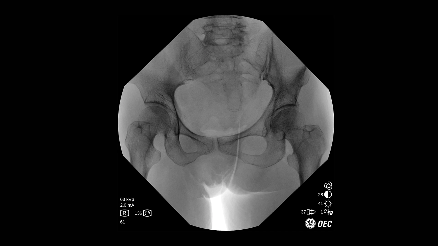 Мобильная С-дуга GE Healthcare OEC One CFD