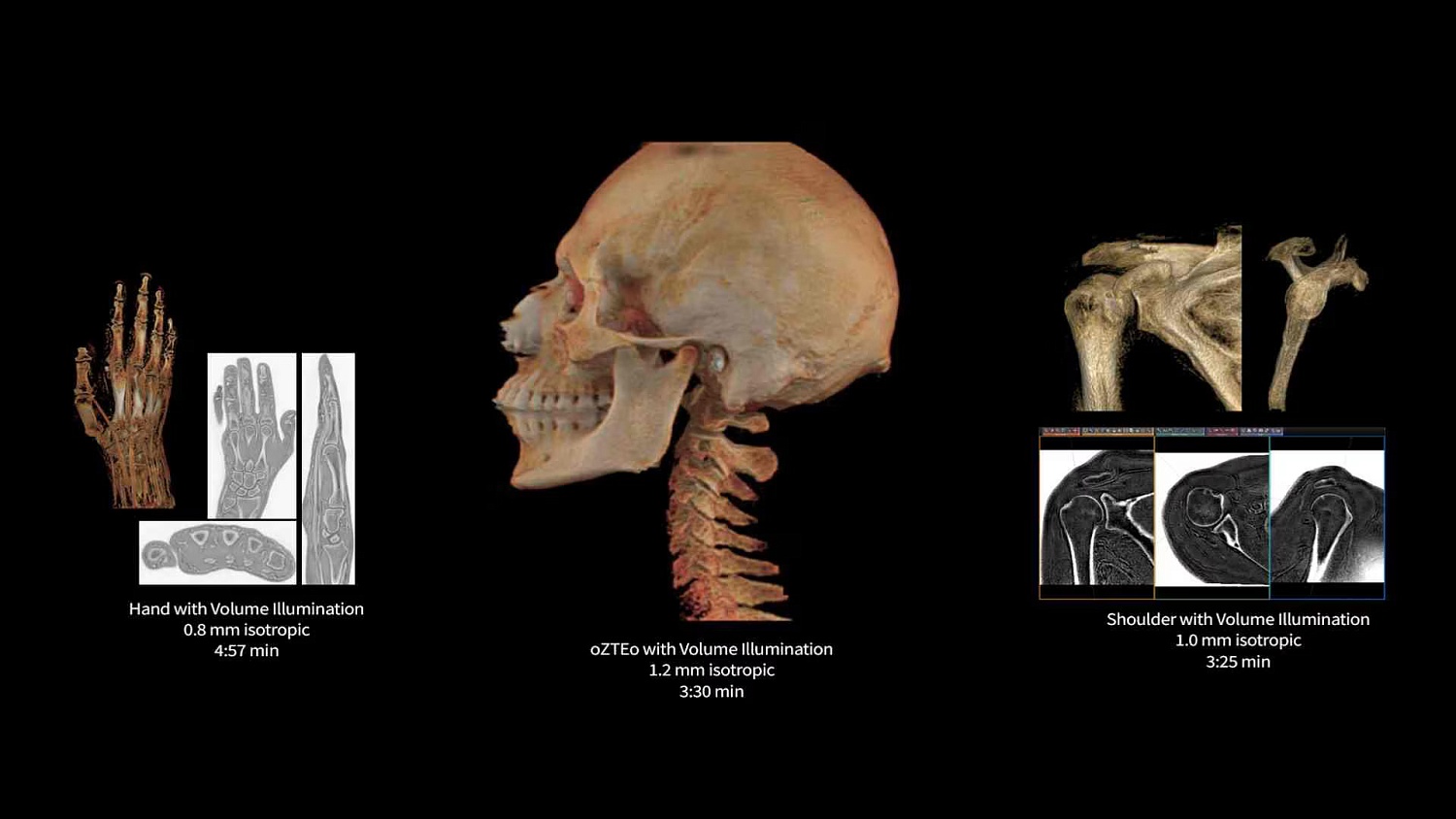 Магнитно-резонансный томограф GE SIGNA Premier 3 Тл.