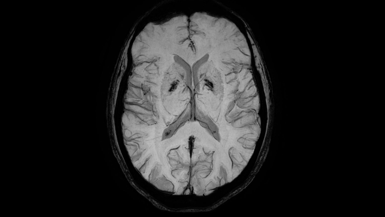 Магнитно-резонансный томограф Philips Ingenia Elition 3.0T S