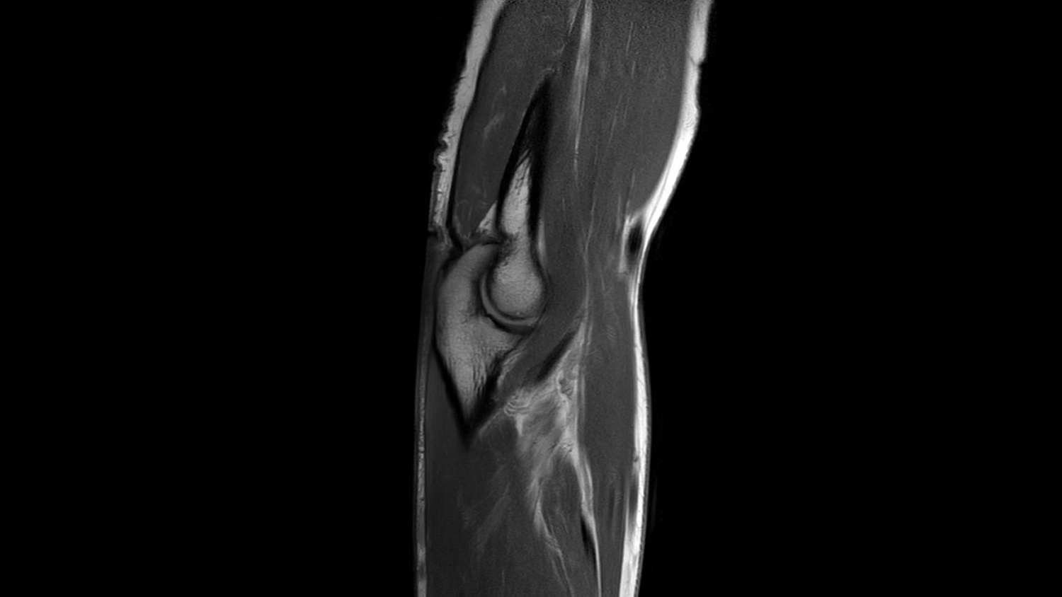 Магнитно-резонансный томограф Philips Ingenia Ambition 1.5T X