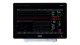 Прикроватный монитор пациента IntelliVue MX750