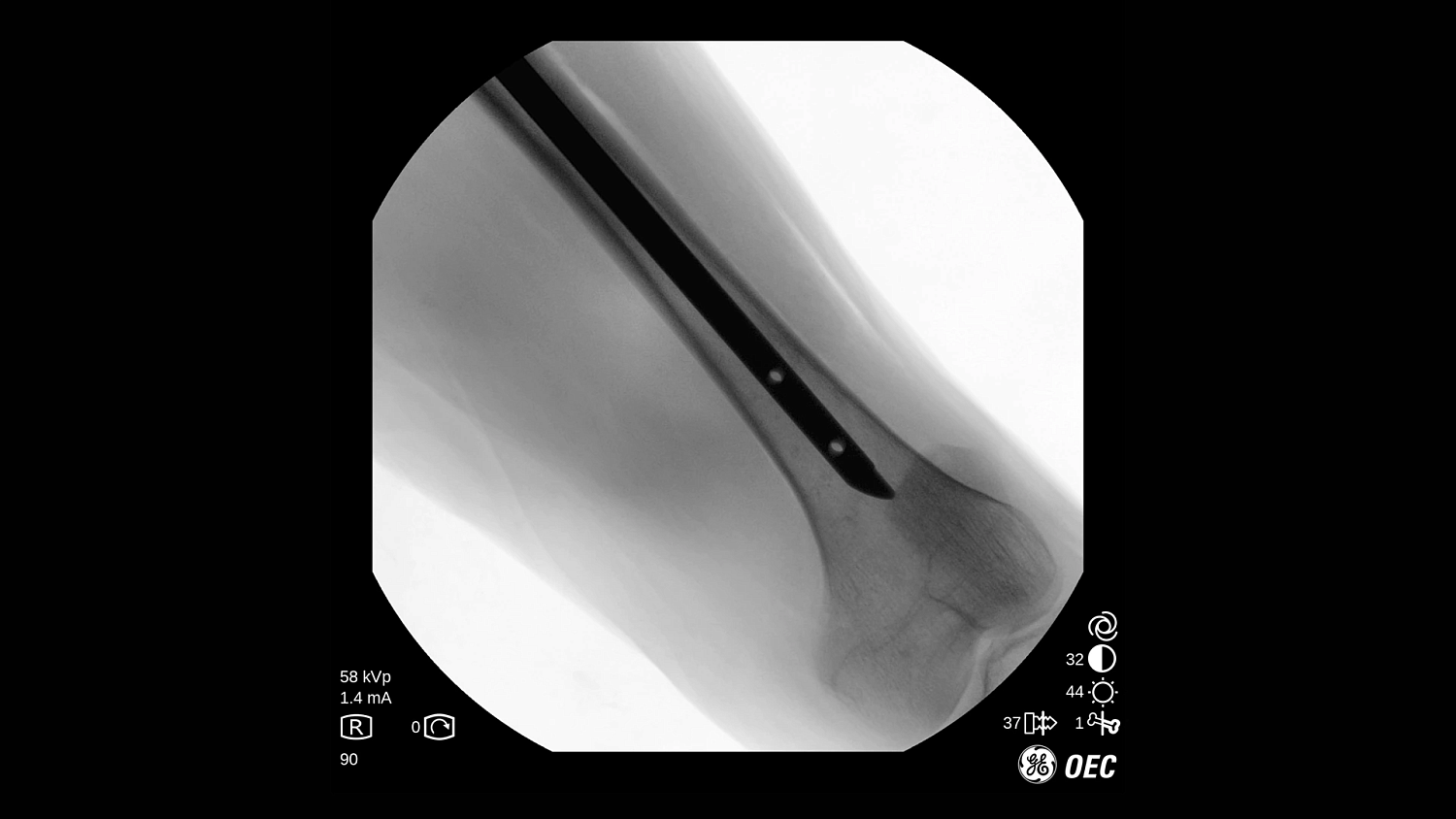 Мобильная С-дуга GE Healthcare OEC One CFD