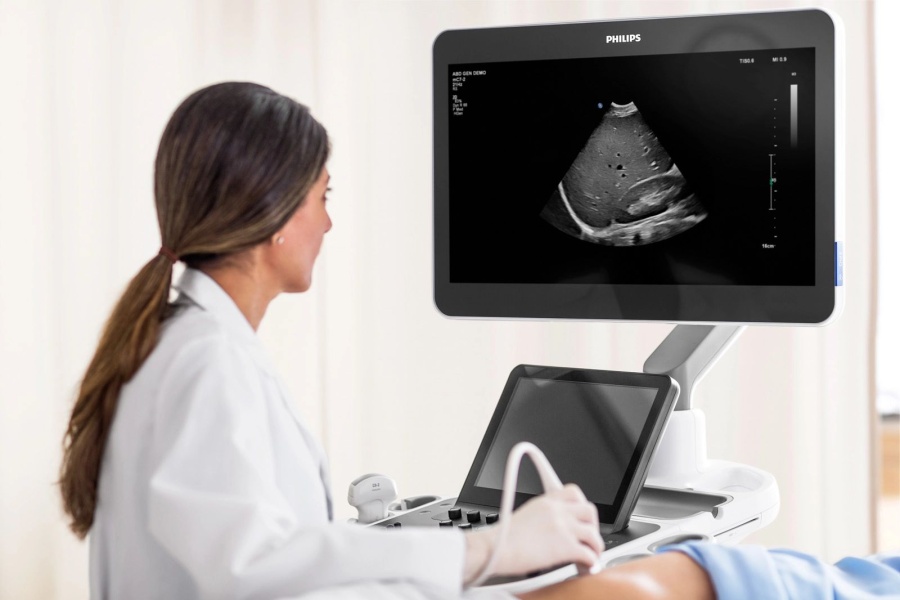 Премиальная ультразвуковая система Philips EPIQ Elite