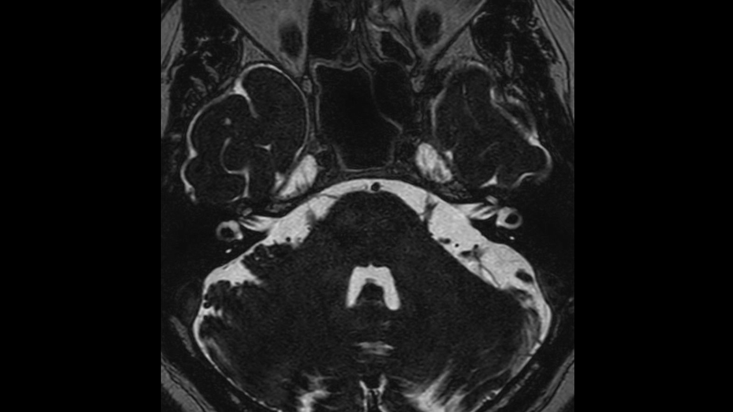 Магнитно-резонансный томограф Philips Ingenia Ambition 1.5T X