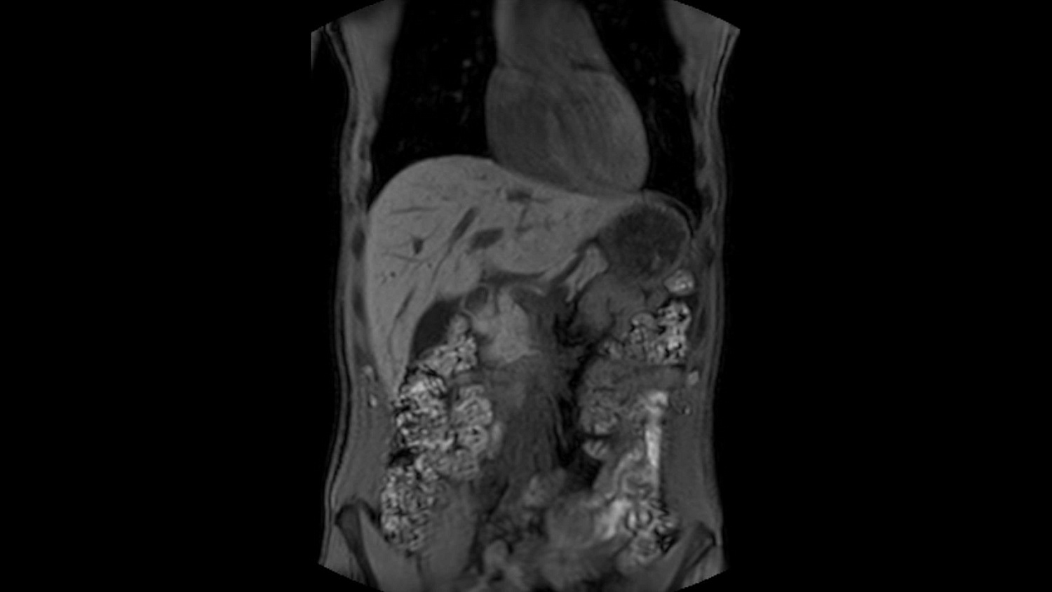 Магнитно-резонансный томограф Philips Ingenia Ambition 1.5T X