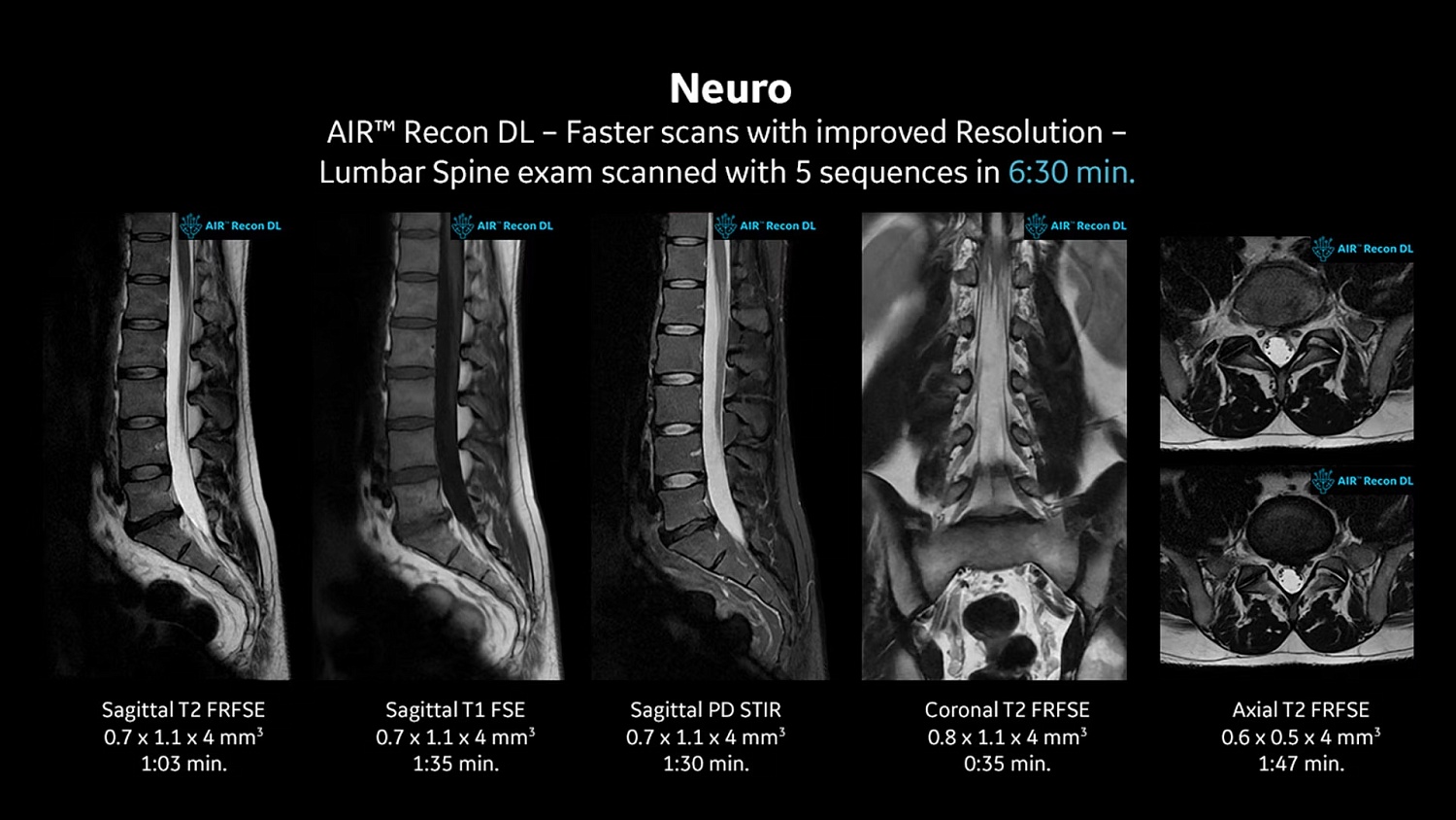 Магнитно-резонансный томограф GE SIGNA Creator 1.5 Тл. 