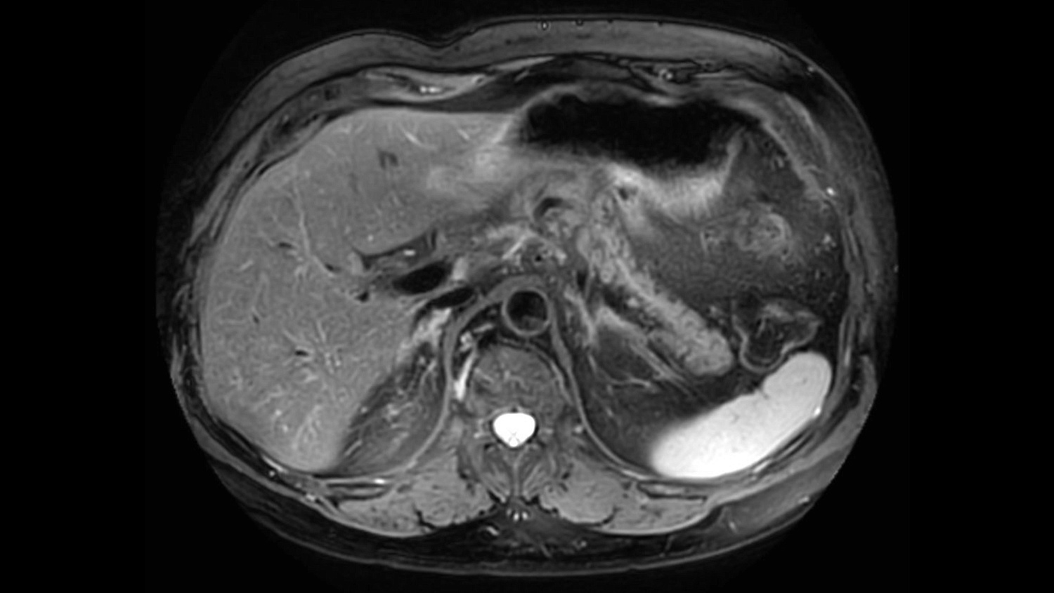 Магнитно-резонансный томограф Philips Ingenia Elition 3.0T S