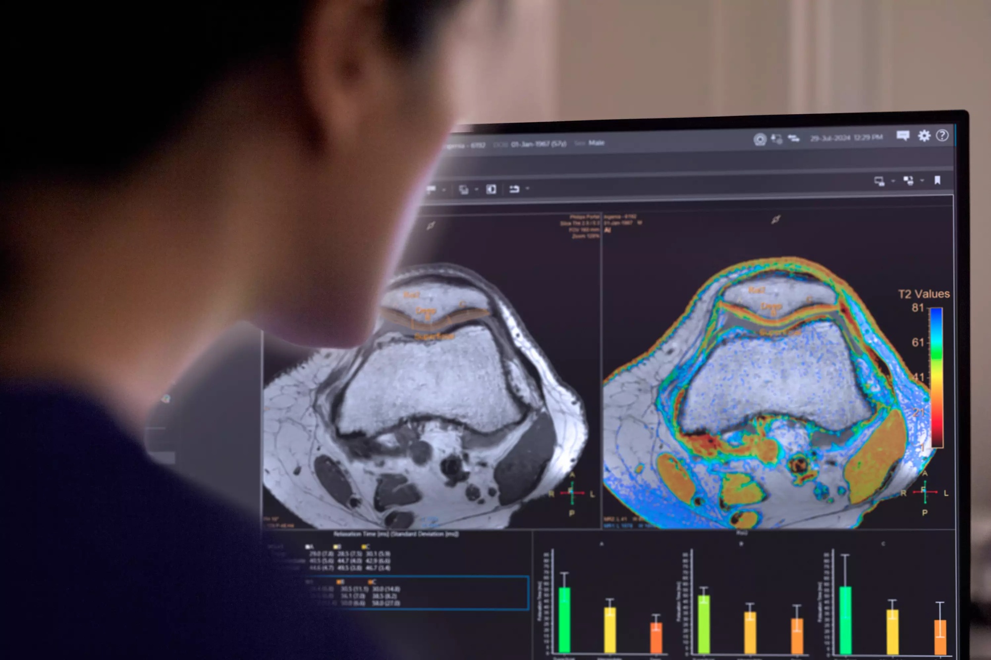 Магнитно-резонансный томограф Philips MR 5300