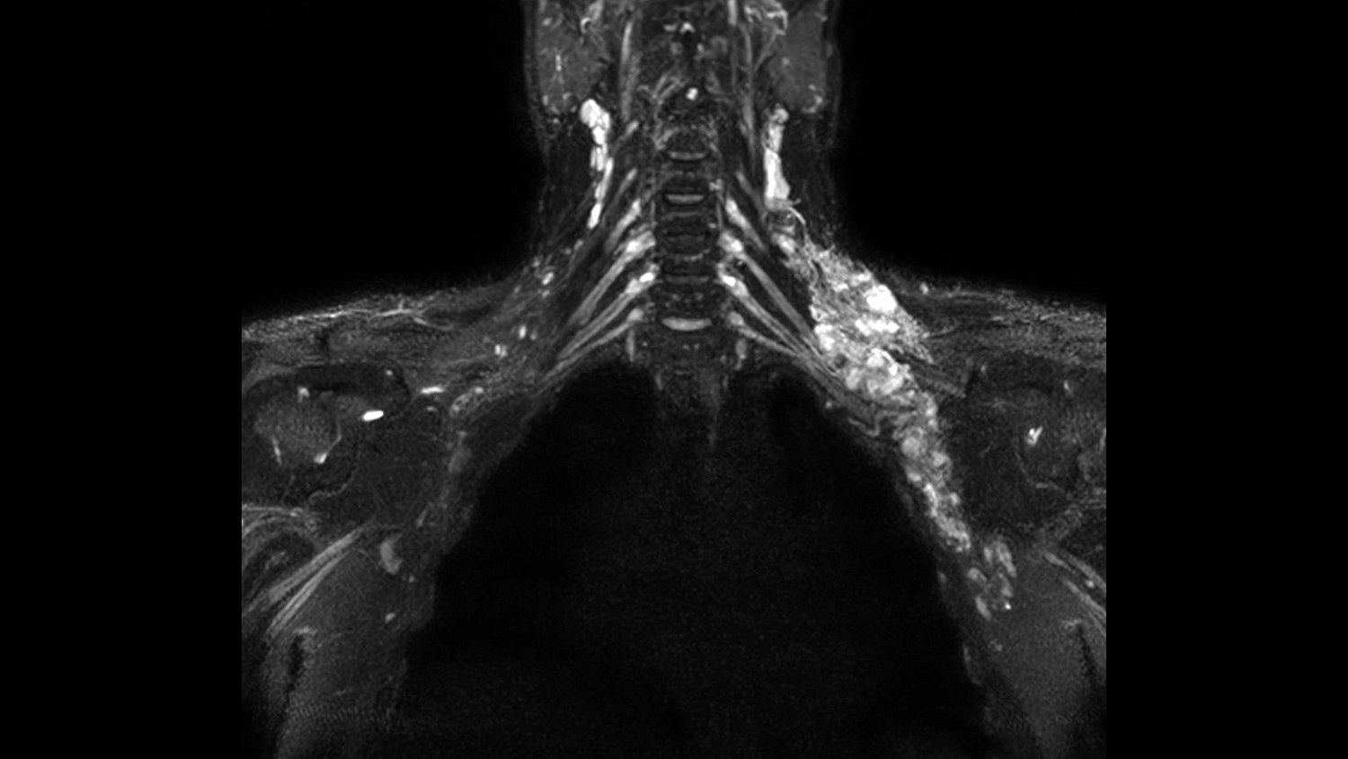 Магнитно-резонансный томограф Philips Ingenia Elition 3.0T S