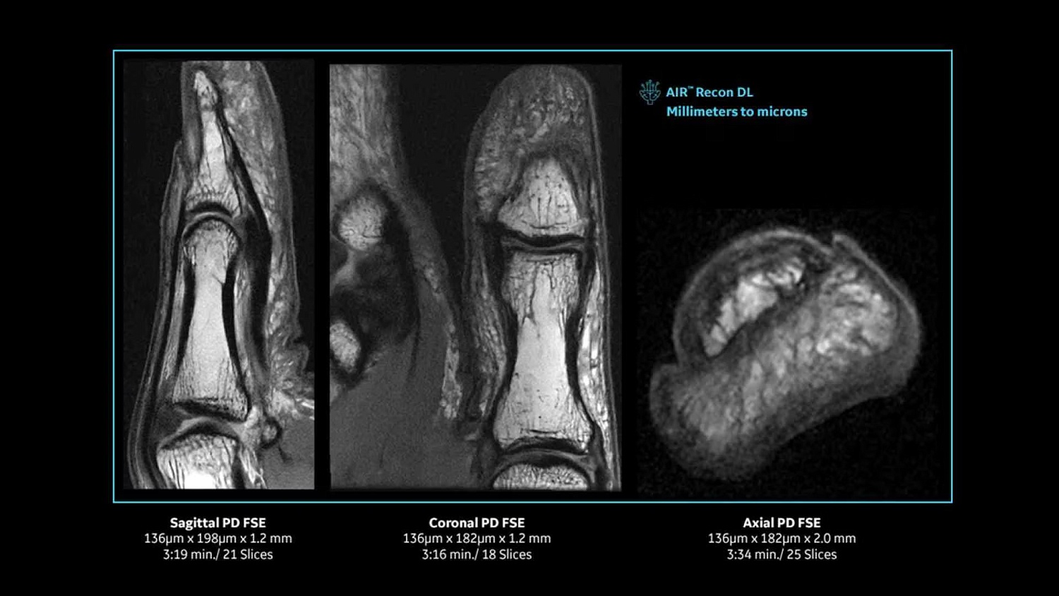 Магнитно-резонансный томограф GE SIGNA Premier 3 Тл.