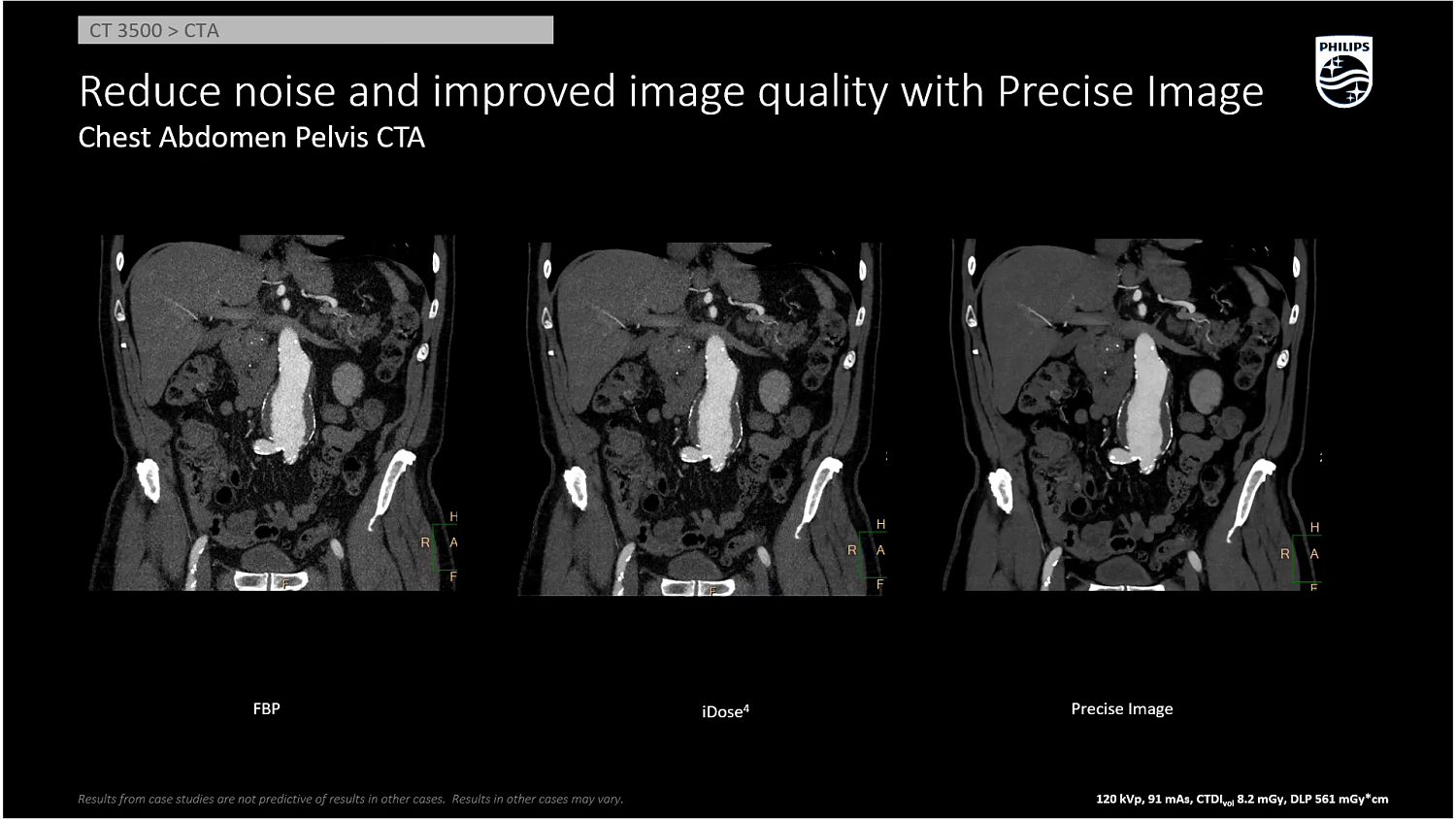 Компьютерный томограф Philips CT 3500