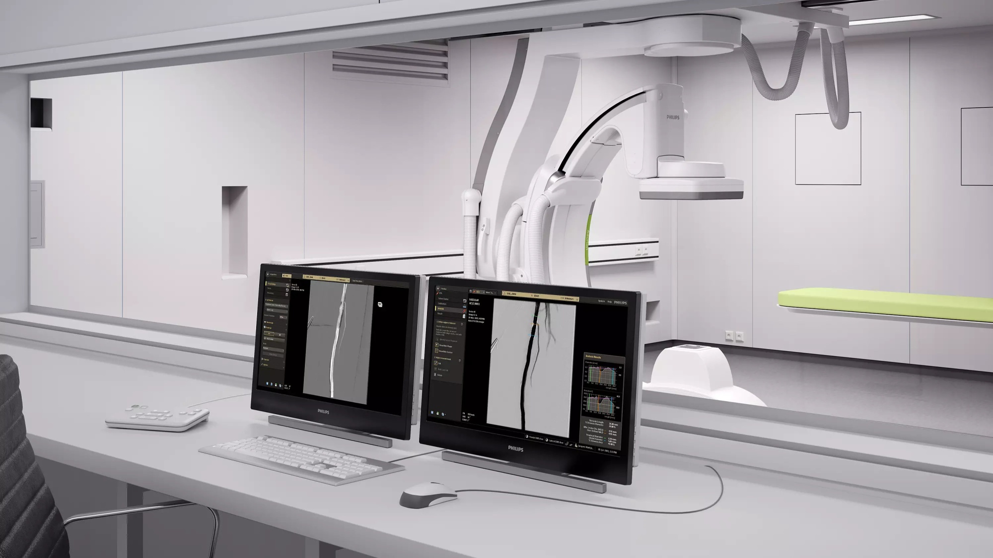 Philips Azurion 3 M12 2