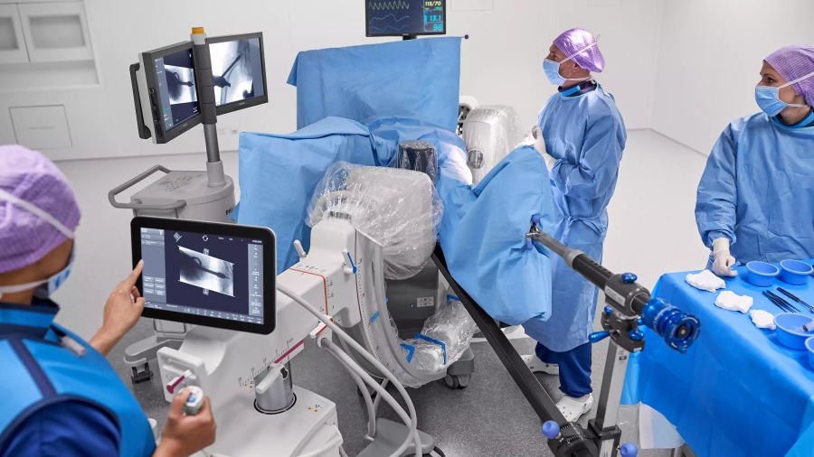 Мобильная С-дуга Philips Zenition 50 с усилителем изображения