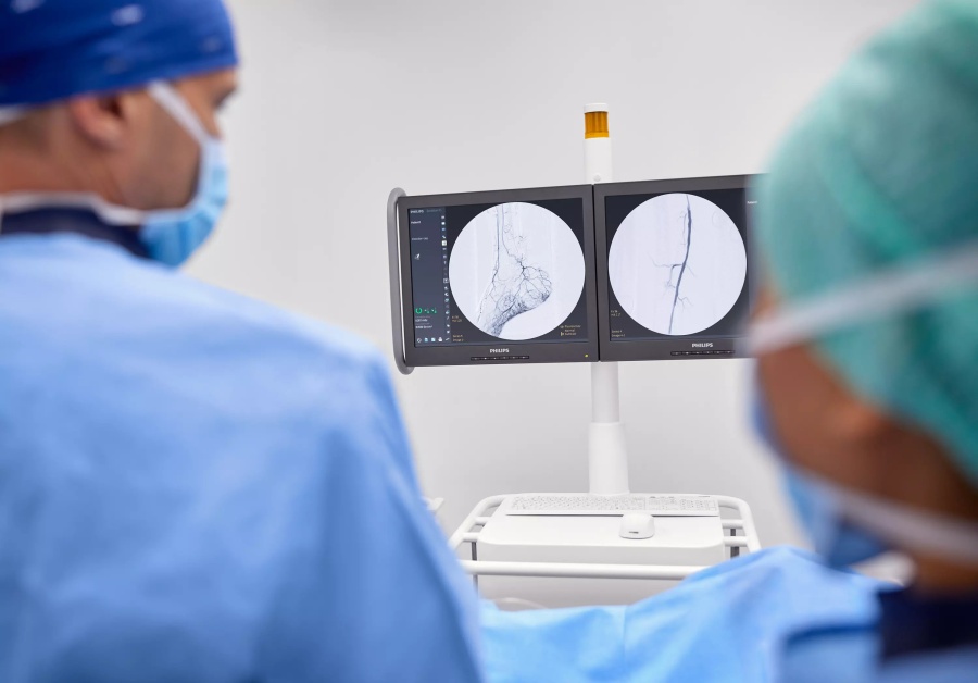 Мобильная C-дуга Philips Zenition 10 с плоским детектором