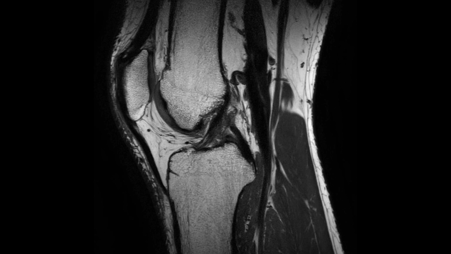 Магнитно-резонансный томограф Philips Ingenia Elition 3.0T S