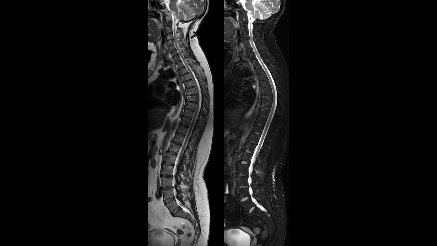 Магнитно-резонансный томограф Philips Ingenia Elition 3.0T S