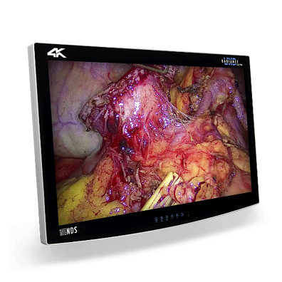 Медицинский монитор Radiance® Ultra 4K 32"