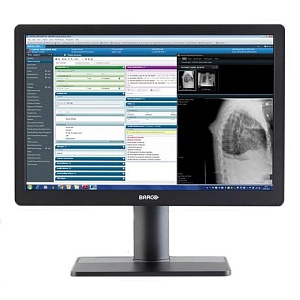 Barco Eonis 24" (MDRC-2324)