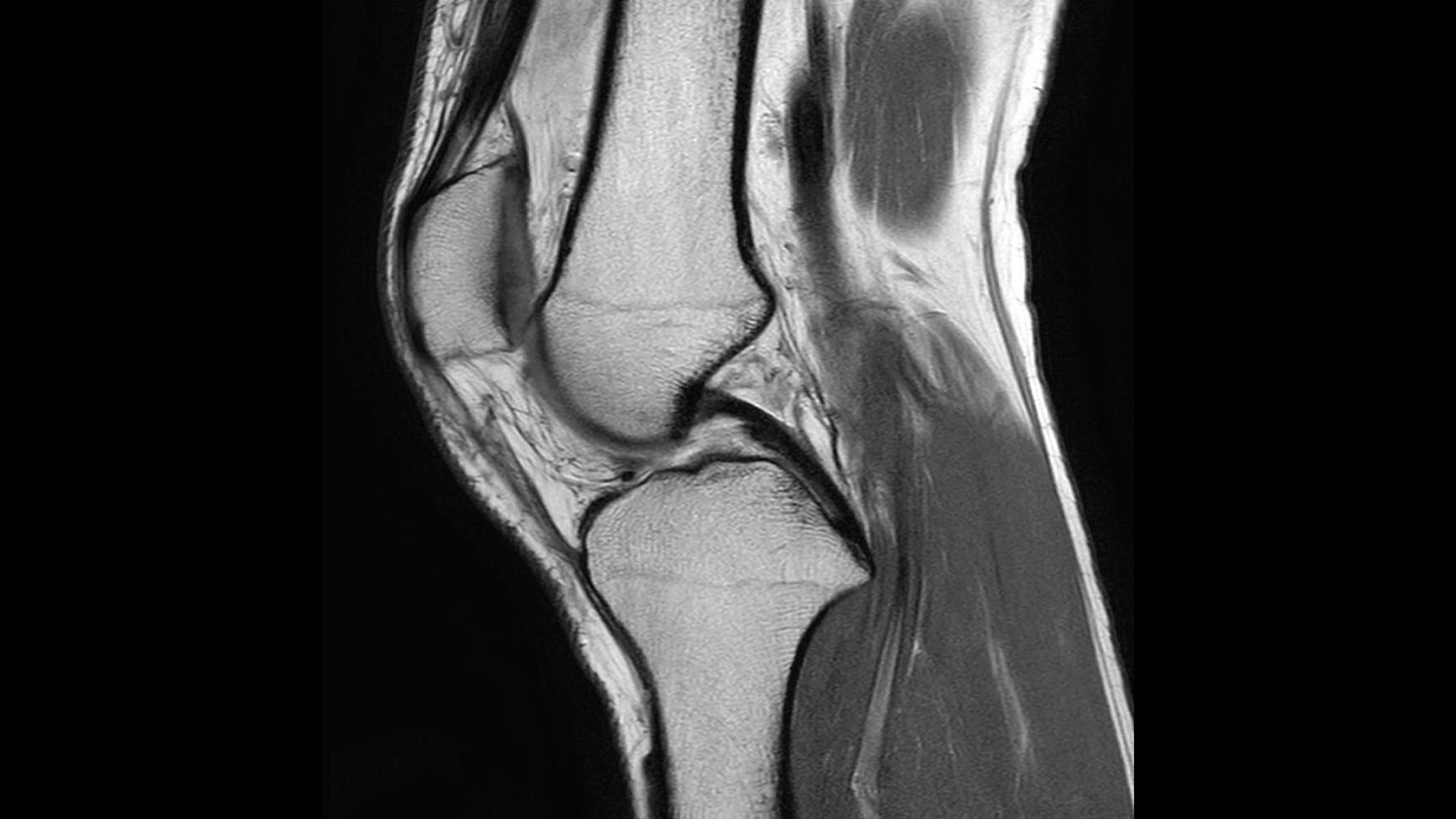 Магнитно-резонансный томограф Philips Ingenia Ambition 1.5T X