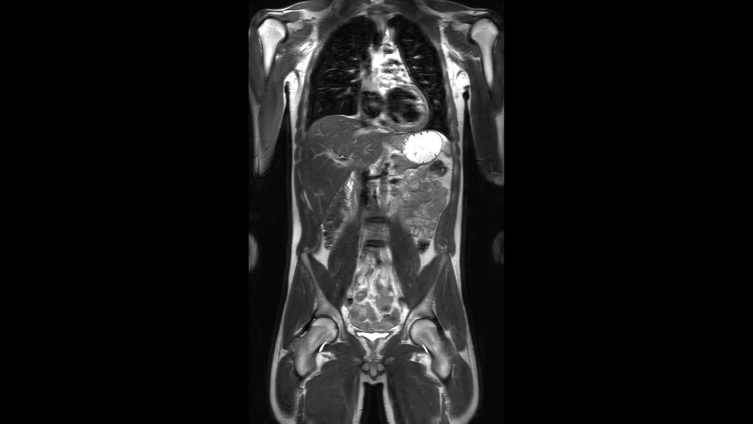 Магнитно-резонансный томограф Philips Ingenia Elition 3.0T S