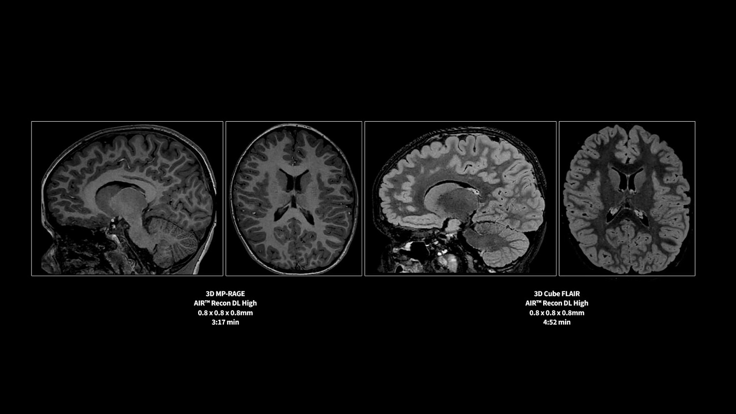 Магнитно-резонансный томограф GE SIGNA Premier 3 Тл.