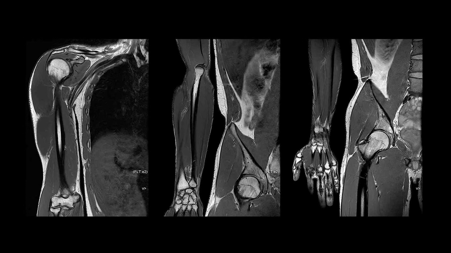 Магнитно-резонансный томограф GE SIGNA Premier 3 Тл.