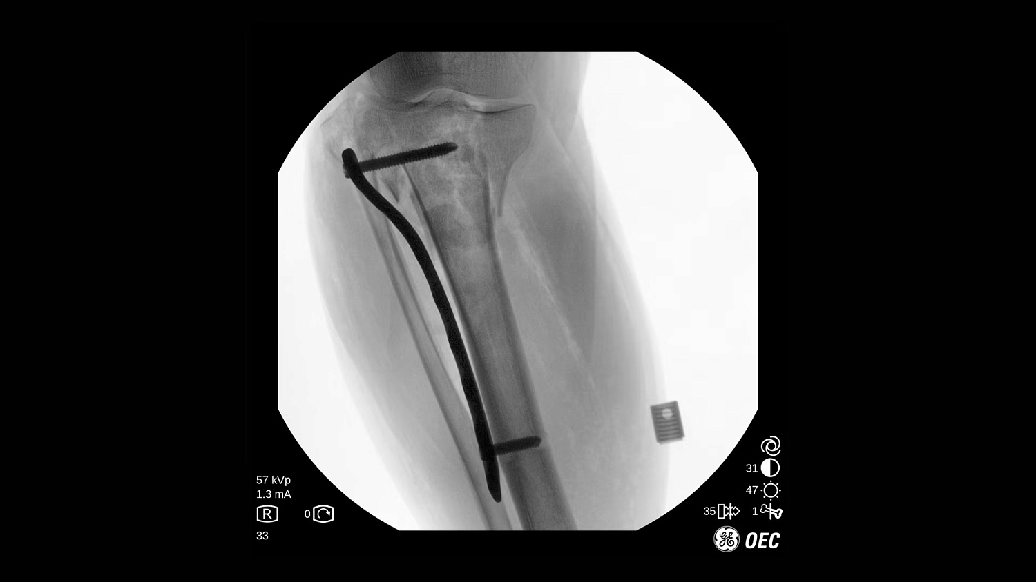 Мобильная С-дуга GE Healthcare OEC One CFD