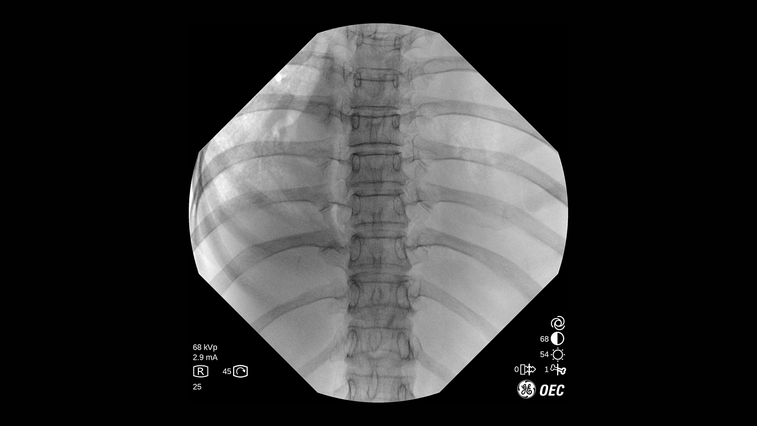Мобильная С-дуга GE Healthcare OEC One CFD