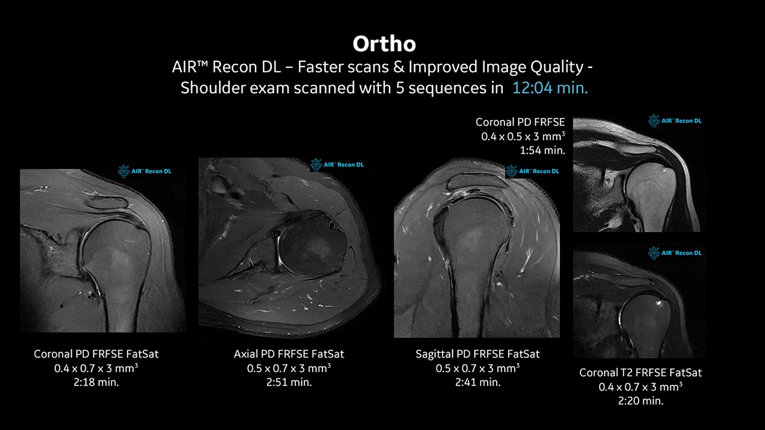 Магнитно-резонансный томограф GE SIGNA Creator 1.5 Тл. 