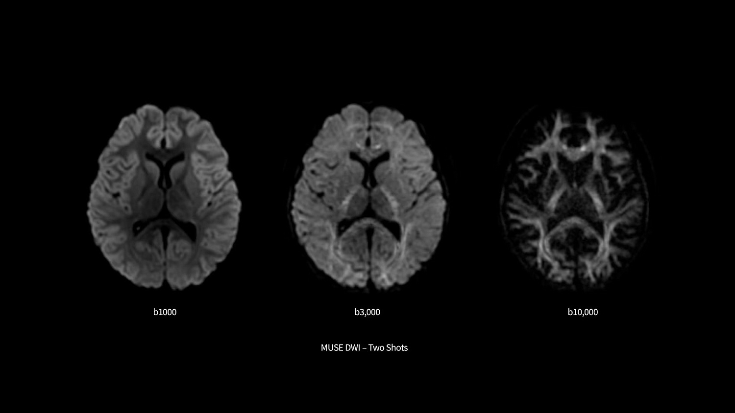 Магнитно-резонансный томограф GE SIGNA Premier 3 Тл.