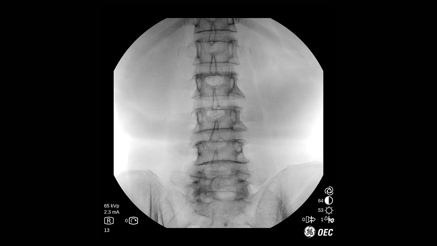 Мобильная С-дуга GE Healthcare OEC One CFD