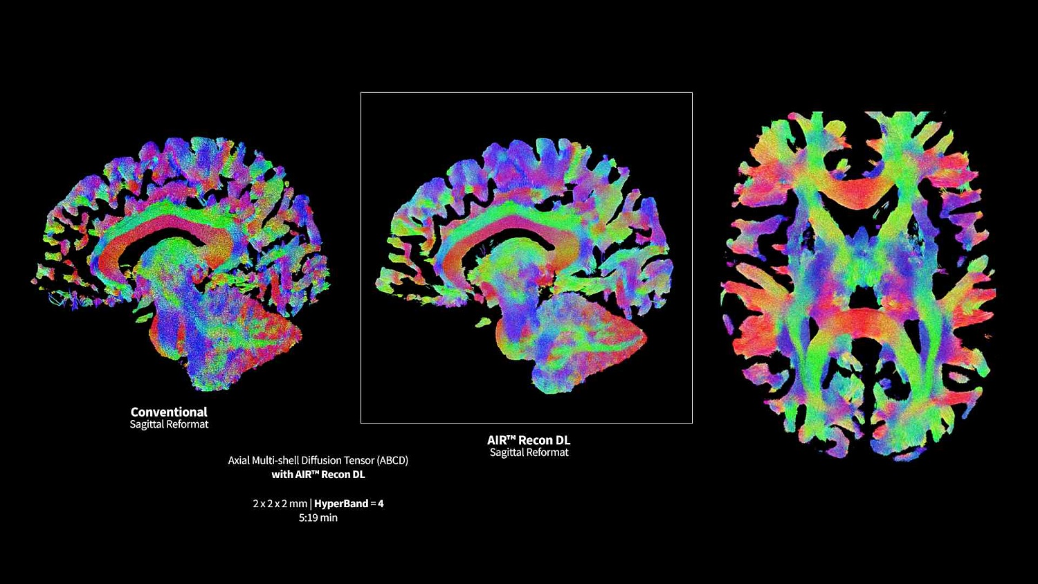 Магнитно-резонансный томограф GE SIGNA Premier 3 Тл.